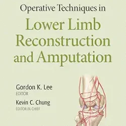 Operative Techniques In Lower Limb Reconstruction And Amputation