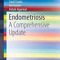 Endometriosis A Comprehensive Update