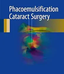 Phacoemulsification Cataract Surgery