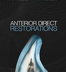 Anterior Direct Restorations
