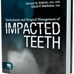 Orthodontic And Surgical Management