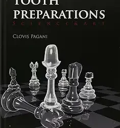 Tooth Preparation Science