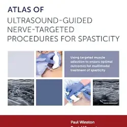 Atlas Of Ultrasound Guided Nerve Targeted