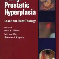 Benign Prostatic Hyperplasia