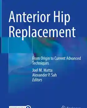 Anterior Hip Replacement