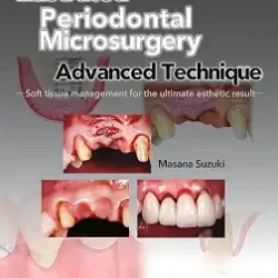 Illustrated Advanced Technique