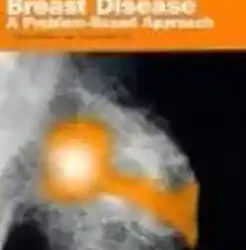 Breast Disease