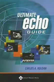 The Ultimate Echo Guide004