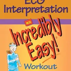 Ecg Interpretation