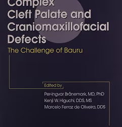 Rehabilitation Of Complex Cleft Palate