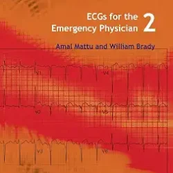 Ecgs For The Emergency Physician