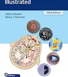 Neuro Ophthalmology Illustrated