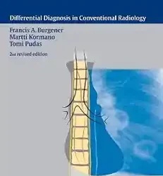 The Chest X-Ray